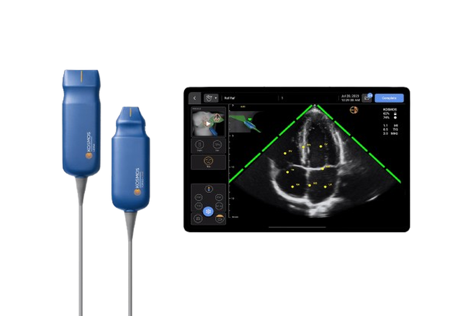 Point-of-care ultrasound probes and display used at Kidan Medical